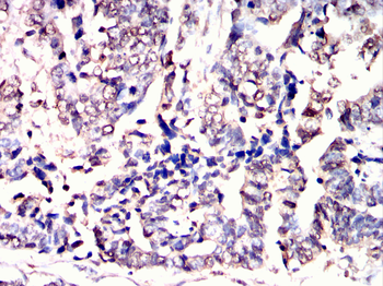ADAMTS4 Antibody