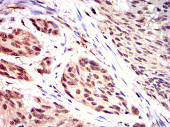 ADAMTS4 Antibody