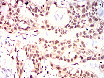 ADAMTS4 Antibody