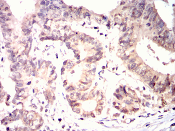 CDCA8 Antibody