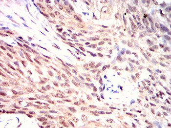 CDCA8 Antibody