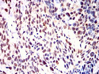LIMK1 Antibody