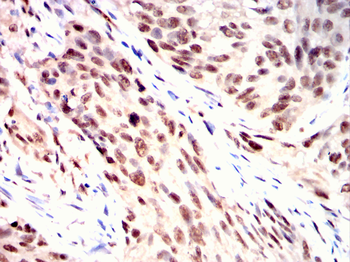 LIMK1 Antibody