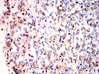 LIMK1 Antibody