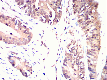 LIMK1 Antibody