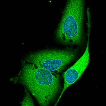 RAB5B Antibody
