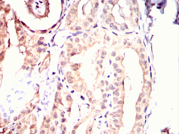 TLE1 Antibody