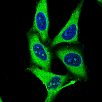 TSC1 Antibody