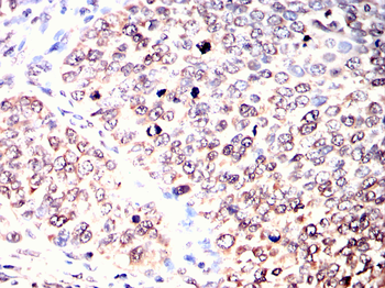 YEATS4 Antibody