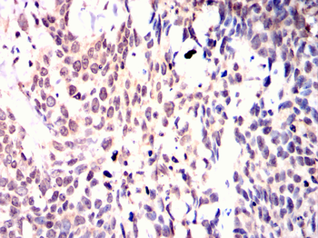 YEATS4 Antibody