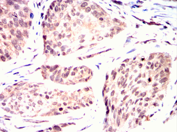 YEATS4 Antibody