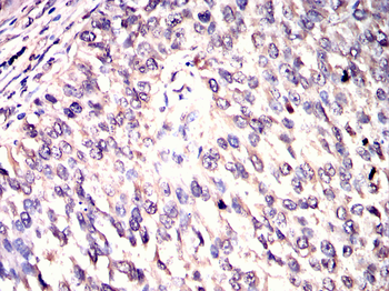 THOC1 Antibody
