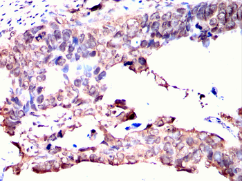 THOC1 Antibody