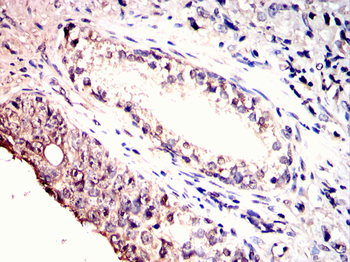 THOC1 Antibody