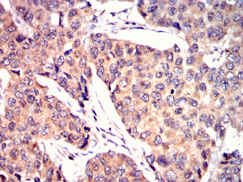 GDF11 Antibody