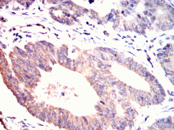 GDF11 Antibody