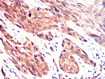 GDF11 Antibody