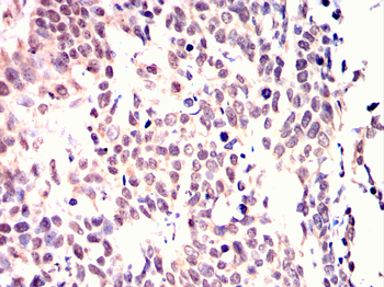 GDF11 Antibody