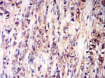 GDF11 Antibody