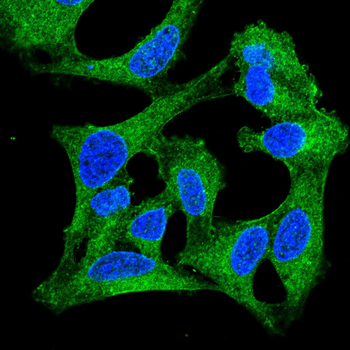CAMKK2 Antibody