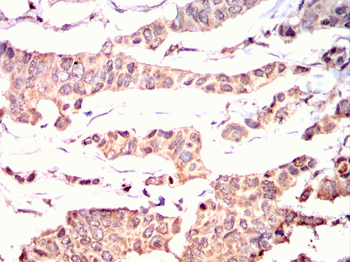 CAMKK2 Antibody