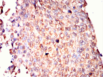 CAMKK2 Antibody