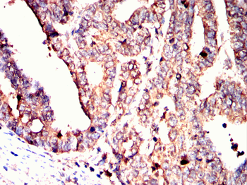 CAMKK2 Antibody