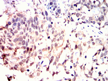 CAMKK2 Antibody