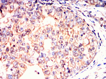 CAMKK2 Antibody