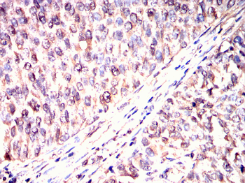 TPX2 Antibody