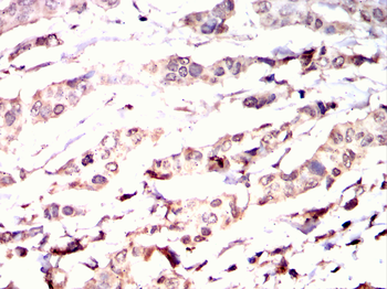 RPS6KL1 Antibody