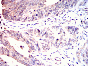 RPS6KL1 Antibody