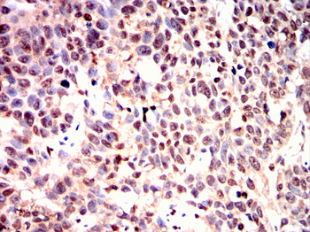RPS6KL1 Antibody