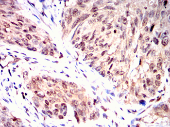 RPS6KL1 Antibody