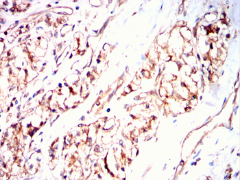 RPS6KL1 Antibody