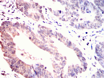 STRA8 Antibody