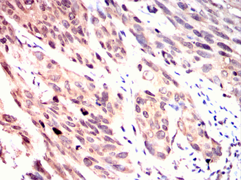 STRA8 Antibody