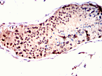 STRA8 Antibody