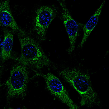SOCS3 Antibody
