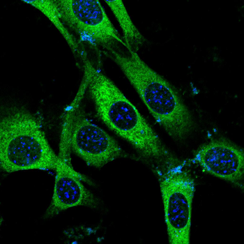 P4HB Antibody