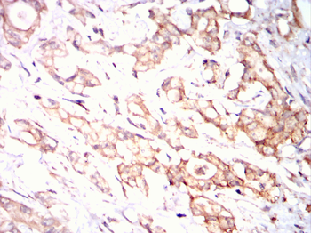 P4HB Antibody