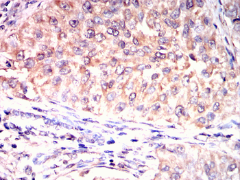 RUVBL1 Antibody