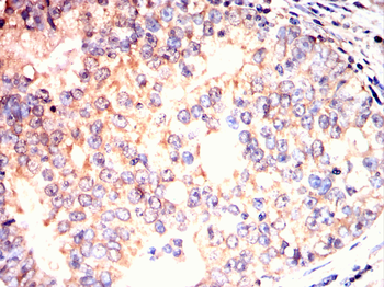 RUVBL1 Antibody