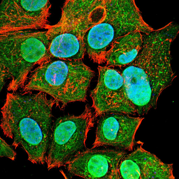 CDK20 Antibody