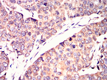 CDK20 Antibody