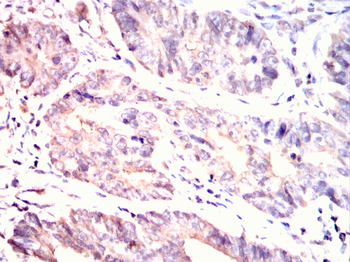 CDK20 Antibody