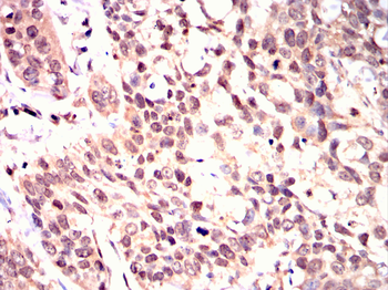 CDK20 Antibody