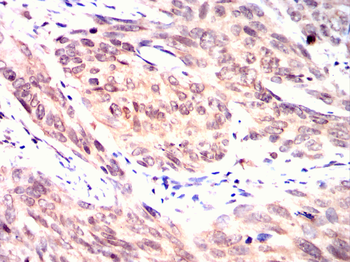 CDK20 Antibody