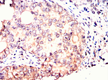 CDK20 Antibody