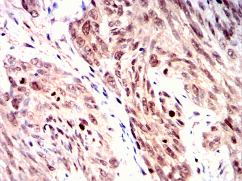 UCHL5 Antibody